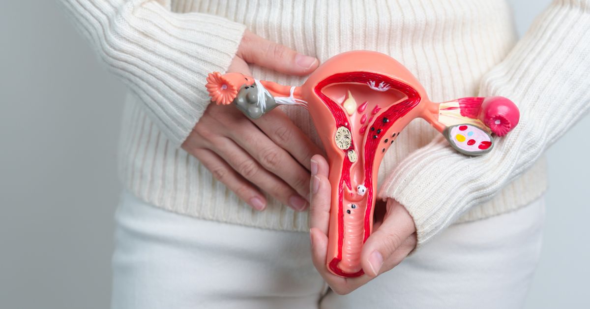 Endométriose et ventre gonflé : comprendre, apaiser, soulager naturellement